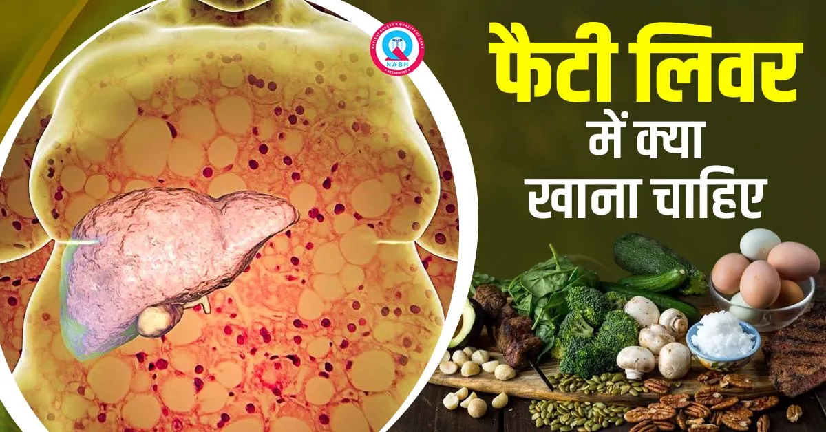 फैटी लिवर में क्या खाना चाहिए